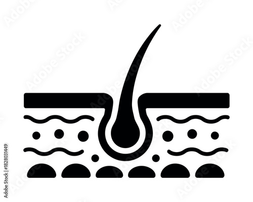 A diagram illustrates the structure of a hair follicle and skin layers.