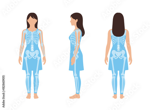 A female patient’s rib cage, pelvis, and spine radiographs are displayed on a white background, shown on a monitor as colorful flat cartoon vector illustrations
