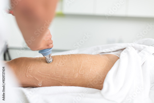 Professional aesthetic treatment on woman’s legs in beauty clinic