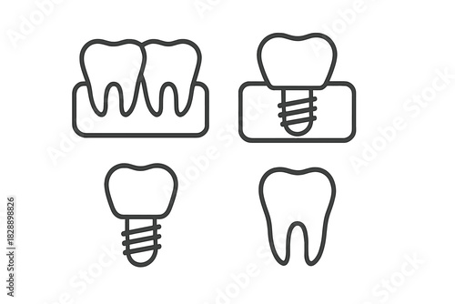 Healthy teeth, gum line, and various stages of tooth implant placement procedure