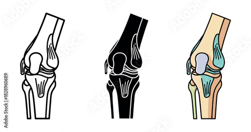 Three styles of anatomical knee joint illustrations: outline, silhouette, colored