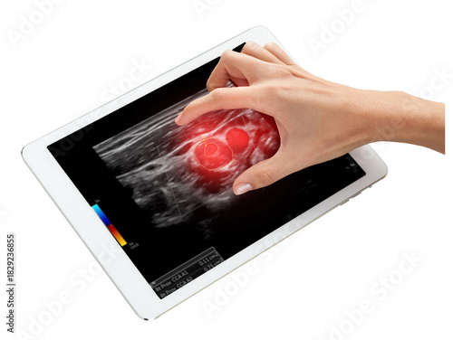 Contemporary medical imaging: An ultrasound of the carotid artery displayed on a sleek tablet, highlighting the integration of technology in health diagnostics