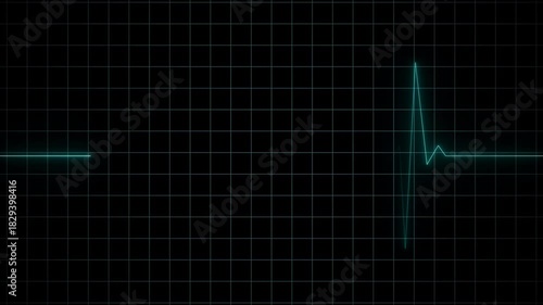 EKG Heart Monitoring Endless loop animation on black background. Full HD. 4K