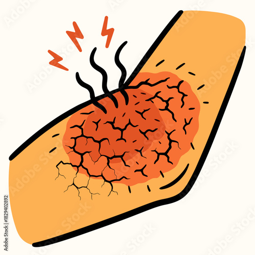 Itchy skin closeup in dry light
