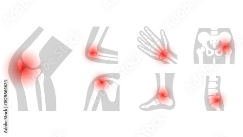 Joint pain illustration showing multiple body areas with red pain markers, including knee, elbow, wrist, shoulder, hip, ankle, and spine. Ideal for medical, health, and anatomy content.