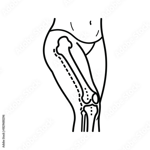 Outline drawing of human leg bones and joints including femur, patella, tibia, and fibula for medical use