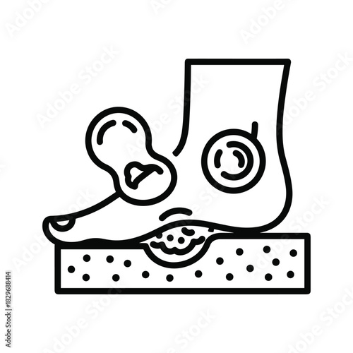 Human foot health issues: depicting bunion, ankle inflammation, and plantar ulcer, a detailed medical icon.