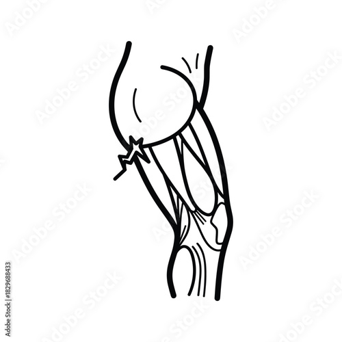Simple line art illustration of human leg anatomy, highlighting muscles and joint with a localized pain symbol.