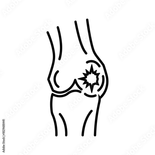 Outline icon of human knee joint with pain, representing injury, arthritis, or discomfort, medical health issue.