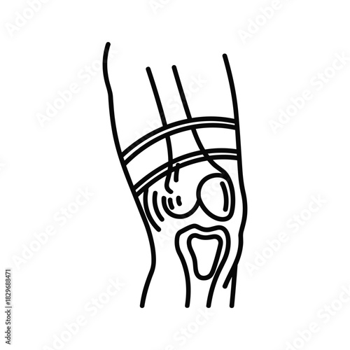 Line art drawing of a human knee joint with a supportive brace, illustrating bones and ligaments for medical concepts.