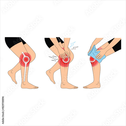 Caucasian woman uses an ice pack and presses on her knee because of pain