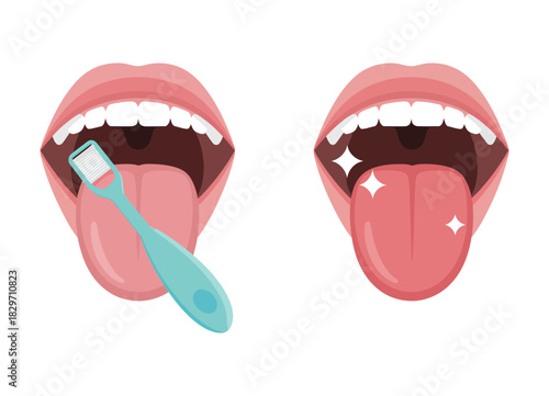 Tongue cleaning process illustration showing a mouth with a scraper and the sparkling fresh result after a proper oral hygiene routine