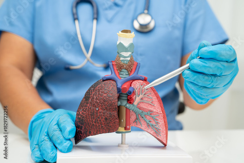 Cirrhosis, Liver cancer, fatty liver, Asian woman with liver human anatomy model.