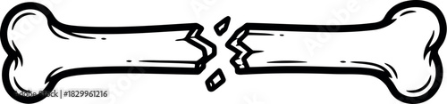 Illustration of a broken bone with jagged edges in a simple sketch style