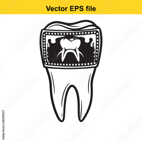 Black and white vector illustration of a molar tooth displaying an xray image of the tooth structure inside a film border, isolated on white background