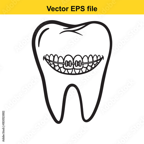 Black and white line art vector illustration of a human molar tooth featuring orthodontic braces on the visible surface, isolated on white background