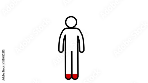 Anemia animation explaining reduced red blood cell levels.