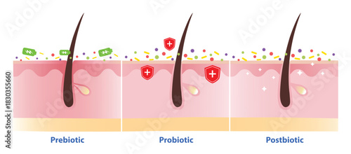 The differences between prebiotic, probiotic and postbiotic on skin illustration. Prebiotic provide energy for probiotic, that are good bacteria support the skin barrier. Postbiotic renew the skin.