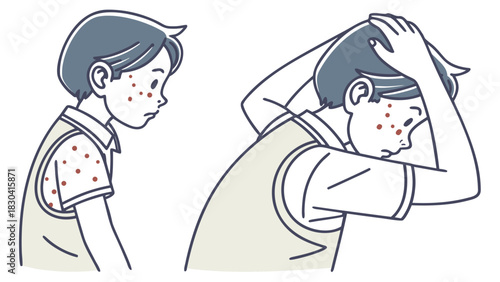 A young boy with red spots on his skin, looking uncomfortable and revealing a rash on his body.