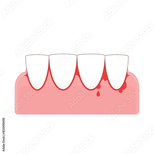 lower front teeth on the gums scurvy disease cartoon cute