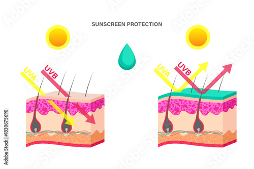 Cartoon Color Sunscreen Protection Template Placard Poster Card Uvb and Uva Rays Penetrate into Human Skin Layered. Vector illustration of Before and After Sunscreen
