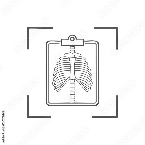 Medical X-ray of Rib Cage and Spine Inside a Frame Indicating Scan