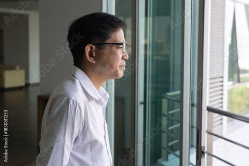 Side portrait of a Asian man with vitiligo, an uneven skin color condition, indoor scene.