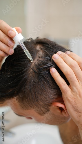 Male scalp serum application with dropper, hairline treatment, scalp care routine in bathroom, hair wellness booster, peptide tonic for thinning hair, cooling effect liquid, healthy scalp focus