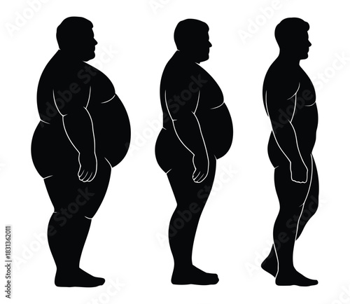 Male Weight Loss Progress Silhouette Set: Before and After Body Transformation Stages