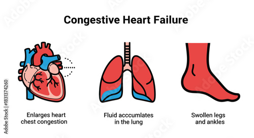 Congestive heart failure symptoms causes and treatment options