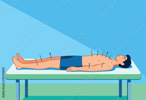 A person lies on a table, undergoing an acupuncture treatment. Needles are inserted in the body. Clean background