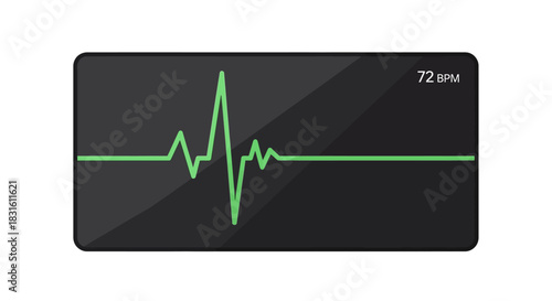 An EKG monitor displays a heartbeat of 72 BPM on a dark screen with a green line and numerical data
