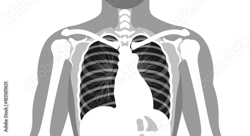 An Xray view of a torso reveals ribcage lungs clavicles shoulder bones humerus sternum and trachea in shades of gray