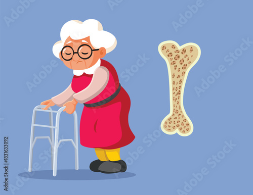 Elderly Woman With Walking Frame Suffers from Osteoporosis. Unhappy unwell senior patient having problems with osteoarthritis
