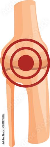Leg bones forming knee joint with red circle highlighting area of inflammation, representing knee pain