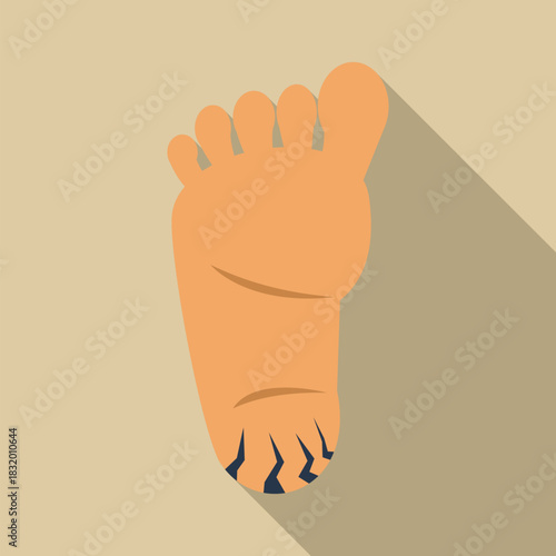 Foot showing cracked dry skin on the heel, a common skin condition