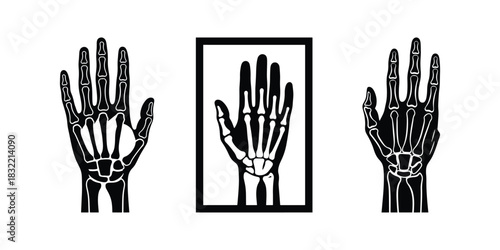 Hand X-ray Silhouette Icon Collection on White Background