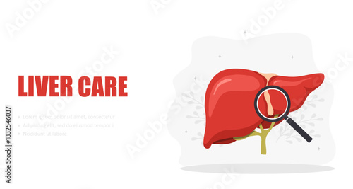 Liver care concept. Internal organ diseases. Medical flat vector illustration with organ model.