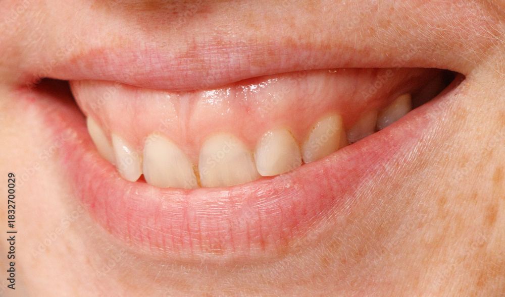 Obraz premium A woman's teeth are visible in a close up