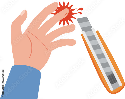 カッター使用中のケガ