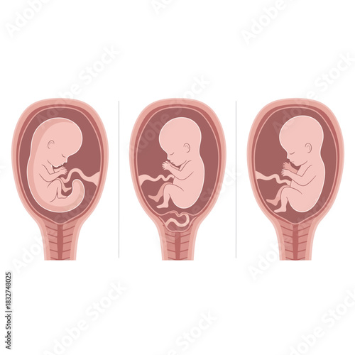 Illustration depicting the stages of human fetal development within the uterus, showcasing growth.