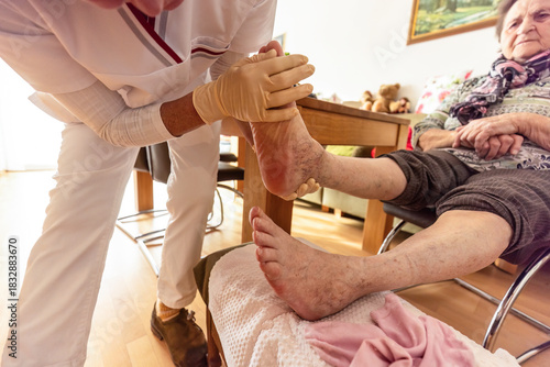 Nurse assessing an elderly woman’s feet for skin changes during preventive pressure ulcer care