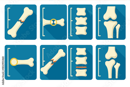 Minimalist X-ray Icons. X-ray Details flat icon set: bone texture, fracture line, joint gap, vertebra shape, soft shadow, highlight ring, scan border, measurement bar