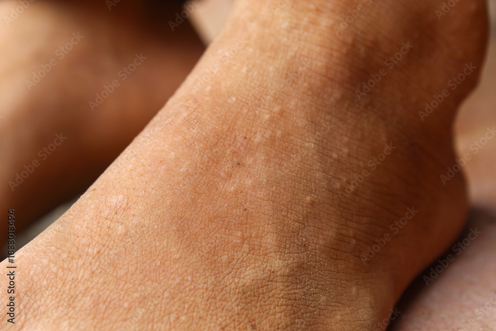 Naklejka premium Close up of the surface of the skin on the feet which looks dry with a smooth texture and small spots 