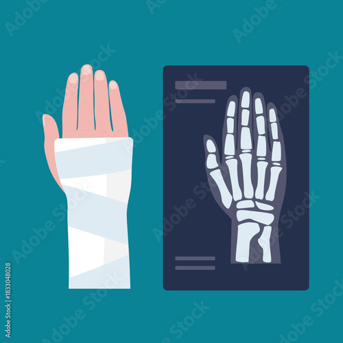 Hand injury treatment. Injured human hand with bandage, medical aid, x-ray. Medicine, health care, accident trauma.