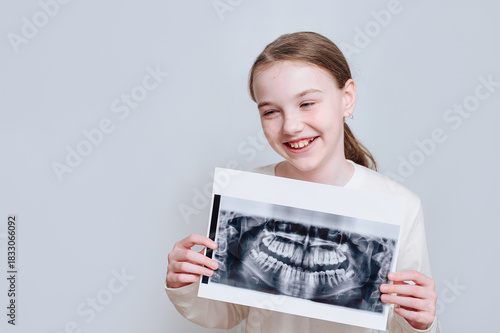 Smiling little girl holding a dental x-ray on a white background, representing child dental care and oral health