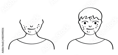 Acne on face. Skincare, dermatology examination concept silhouette. Food allergy. Red spots on body. Itchy skin.