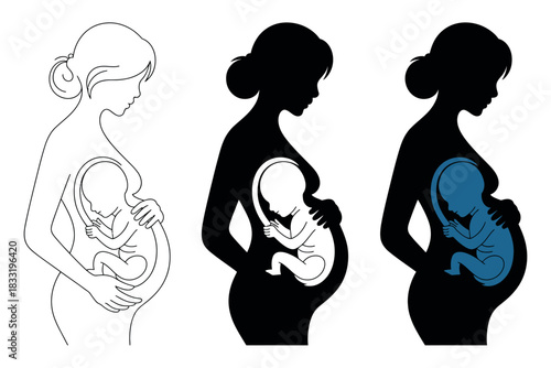 Three stylized illustrations of pregnant women with fetus inside, in outline and silhouette