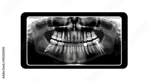 Panoramic Dental XRay A Comprehensive View of Oral Health.