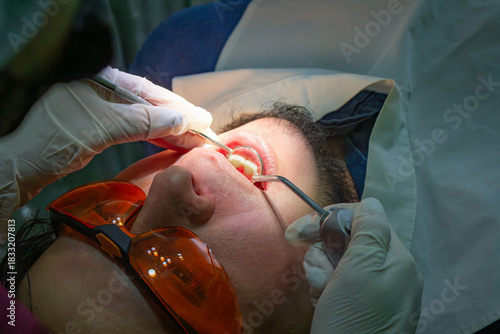 Patient receiving dental scaling and cleaning treatment in clinic